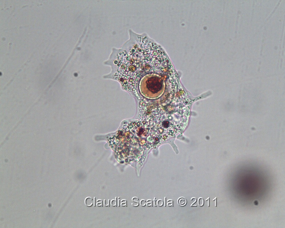 Ameba ed ematococco (Haematococcus pluvialis)